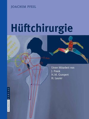 cover image of Hüftchirurgie